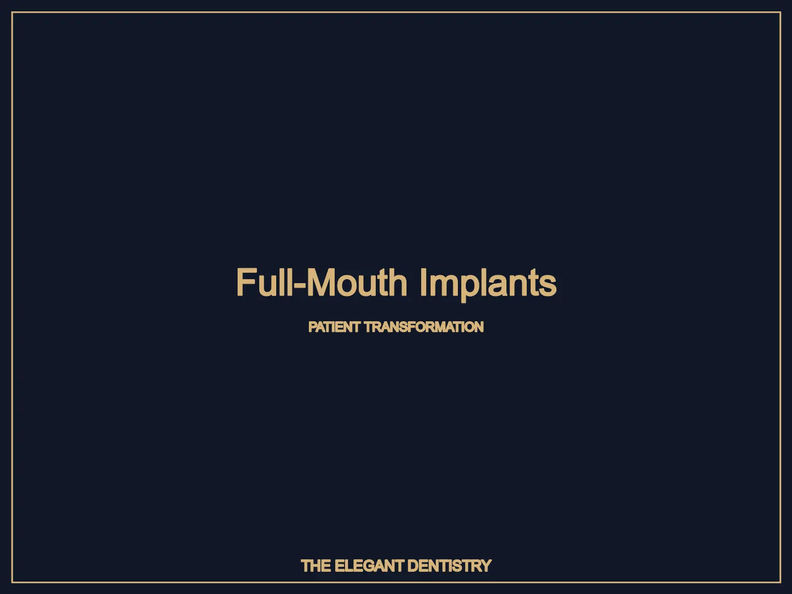 Full mouth dental implant transformation