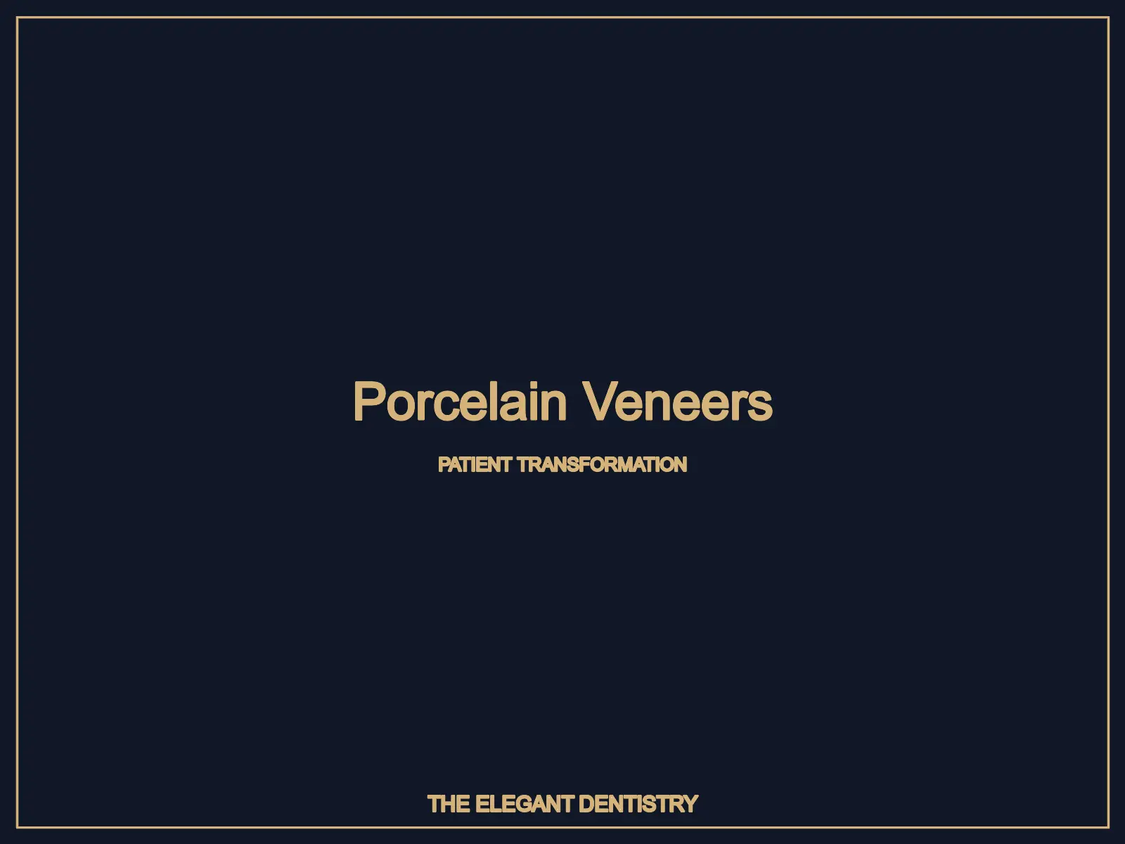 Porcelain veneer smile makeover